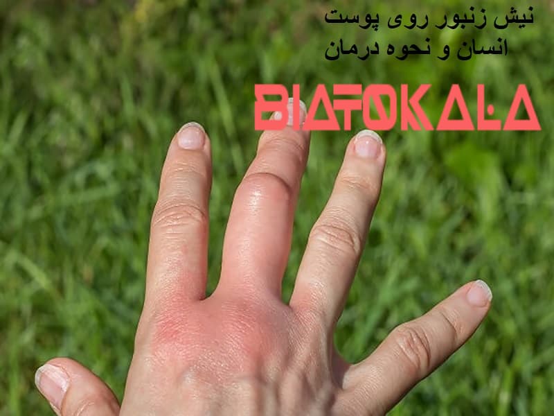 نیش زنبور 
